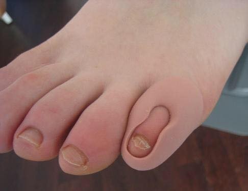 Orthoplastie